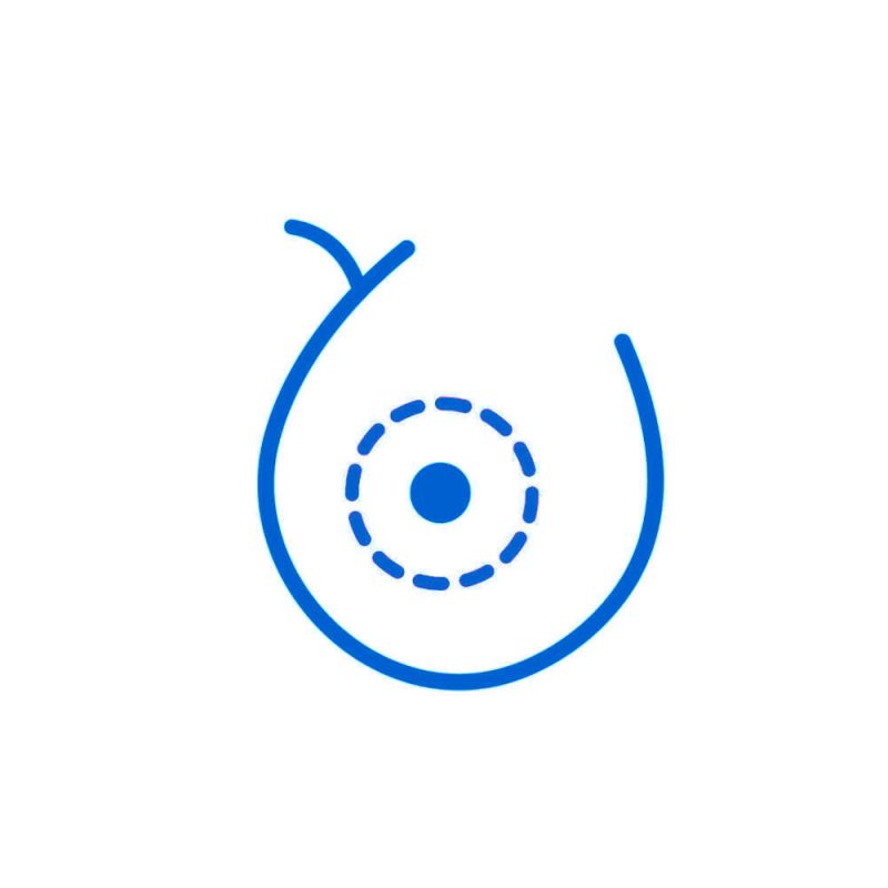 Pigmenti areola